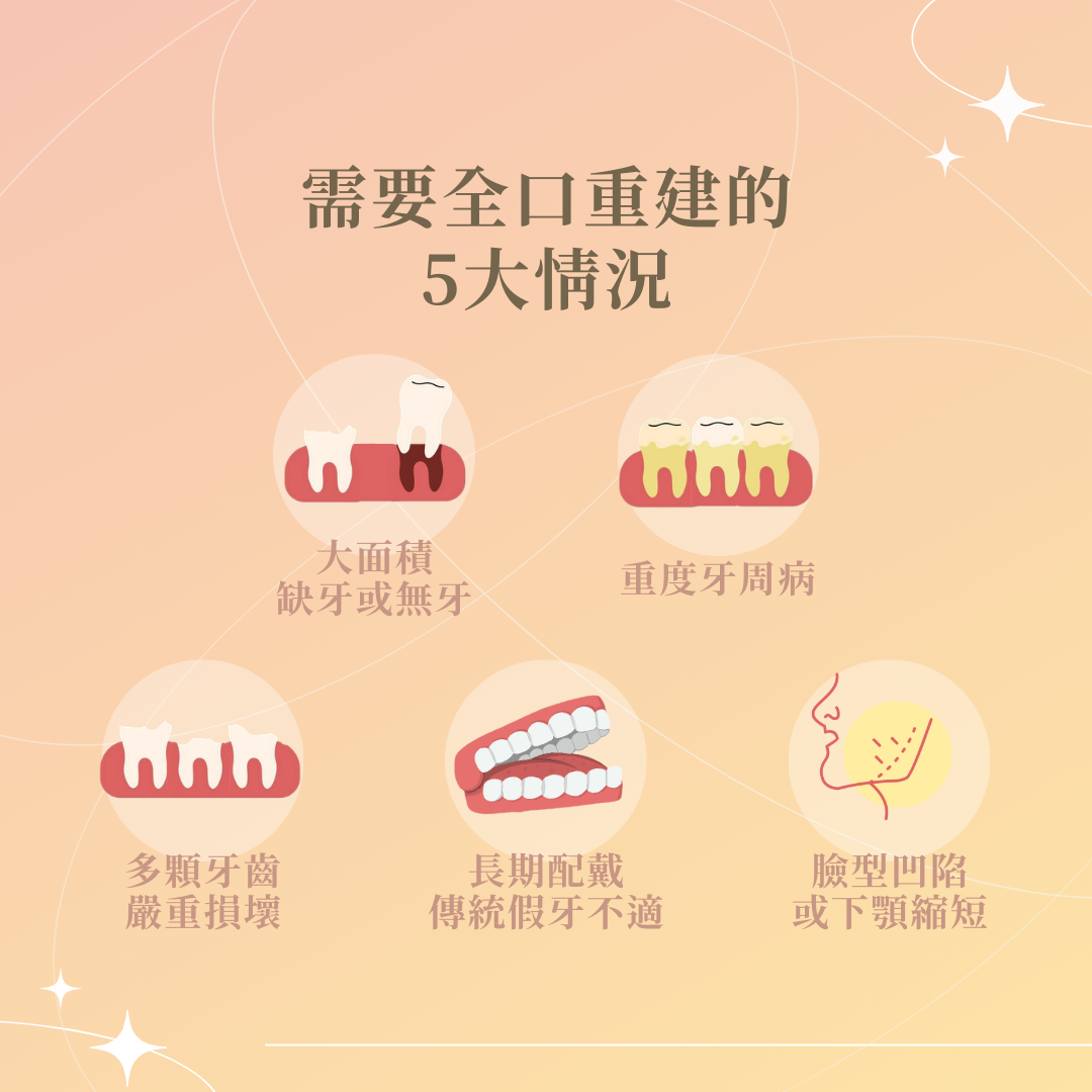 什麼人需要全口重建